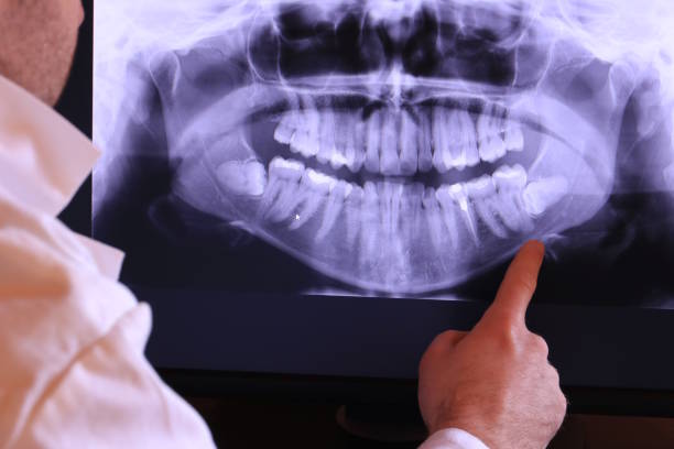 Best Emergency Root Canal Treatment in Cushing, OK
